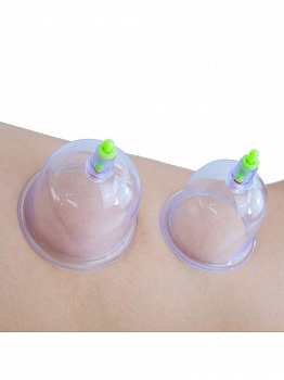 00026811 Набор вакуумных массажных банок 00026811 Набор вакуумных массажных банок